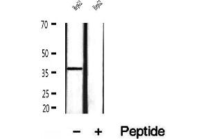 Western blot analysis of extracts of HepG2 cells, using MAT2B antibody.