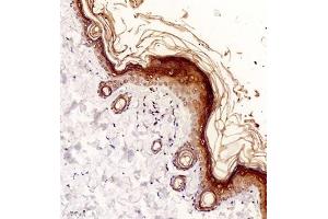 Immunohistochemistry of paraffin embedded rat skin using NCK (ABIN7074783) at dilution of 1:2000 (200x lens) (NCK2 抗体)
