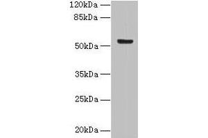 Western blot All lanes: DENND2D antibody at 4 μg/mL + MCF-7 whole cell lysate Secondary Goat polyclonal to rabbit IgG at 1/10000 dilution Predicted band size: 54 kDa Observed band size: 54 kDa (DENND2D 抗体  (AA 1-233))