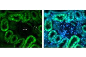Immunofluorescence (IF) image for anti-Solute Carrier Family 2 (Facilitated Glucose Transporter), Member 2 (SLC2A2) (C-Term) antibody (ABIN5596790)