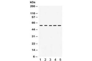Western blot testing of 1) rat intestine, 2) human HeLa, 3) human COLO320, 4) mouse NIH3T3 and 5) mouse HEPA lysate with IRF5 antibody.