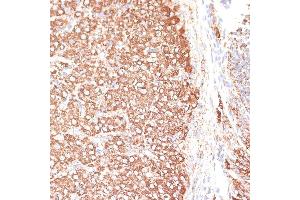 Immunohistochemistry of paraffin-embedded rat ovary using KCNS3 antibody (ABIN6132153, ABIN6142774, ABIN6142775 and ABIN6223897) at dilution of 1:100 (40x lens). (KCNS3 抗体  (AA 1-180))