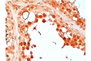 Paraffin Embedded Human Testis stained with UBE2R2 antibody at 2 μg/ml. (UBE2R2 抗体  (N-Term))