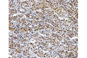 IHC analysis of NDUFS8 using anti-NDUFS8 antibody (ABIN7599086).