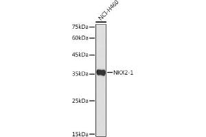 Western blot analysis of extracts of NCI-H460 cells, using NKX2-1 antibody (ABIN3017367, ABIN3017368, ABIN1681058 and ABIN6220056) at 1:500 dilution. (NKX2-1 抗体)