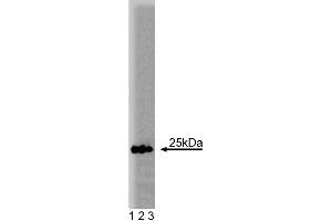 Western blot analysis of Rab5 on human endothelial lysate. (RAB5 抗体  (AA 1-215))