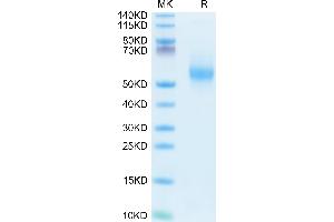 Human IL-3 on Tris-Bis PAGE under reduced condition. (IL-3 Protein (AA 20-152) (Fc Tag))