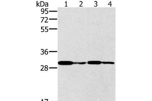 Western Blot analysis of K562 cell and Human liver cancer tissue, Jurkat and A549 cell using PNMT Polyclonal Antibody at dilution of 1:400 (PNMT 抗体)