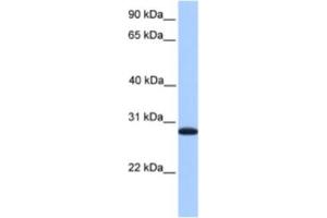 Western Blotting (WB) image for anti-Cyclin-Dependent Kinase Inhibitor 3 (CDKN3) antibody (ABIN2463585) (CDKN3 抗体)
