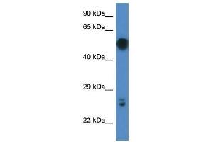 Western Blot showing Gal3st4 antibody used at a concentration of 1. (GAL3ST4 抗体  (C-Term))