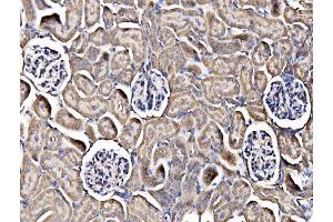 IHC analysis of Integrin Linked ILK using anti-Integrin Linked ILK antibody (ABIN7599411). (ILK 抗体  (AA 1-452))