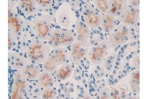 Detection of IL10 in Rat Kidney Tissue using Monoclonal Antibody to Interleukin 10 (IL10) (IL-10 抗体  (AA 19-178))