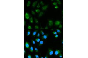 Immunofluorescence analysis of MCF7 cell using UCP3 antibody. (UCP3 抗体  (AA 1-110))