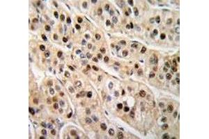 Immunohistochemistry (IHC) image for anti-Proliferating Cell Nuclear Antigen (PCNA) (AA 231-261) antibody (ABIN3032321)