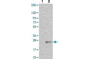 Western blot analysis of Lane 1: Negative control (vector only transfected HEK293T lysate). (TMEM97 抗体)
