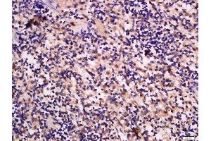 Formalin-fixed and paraffin embedded rat spleen labeled with Anti-GRB10/14 Polyclonal Antibody, Unconjugated  at 1:300 followed by conjugation to the secondary antibody and DAB staining. (GRB10/14 (AA 501-594) 抗体)