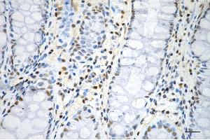 Immunohistochemistry was performed on paraffin-embedded human sigmoid colon carcinoma using phospho-histone H3 (S28) antibody (ABIN7798976), 1:200). (Recombinant Histone 3 抗体  (H3S28ph))