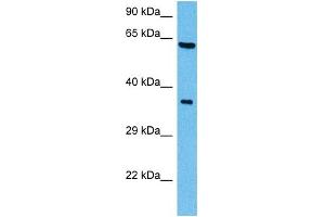 Host:  Mouse  Target Name:  SHC1  Sample Tissue:  Mouse Brain  Antibody Dilution:  1ug/ml (SHC1 抗体  (C-Term))
