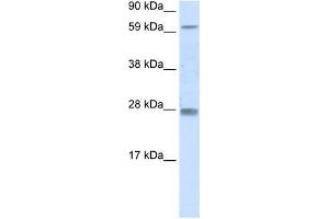 RHOX11 antibody used at 0. (RHOX11 抗体  (N-Term))
