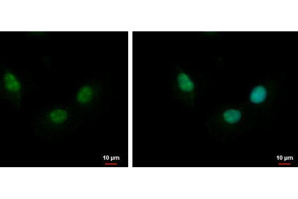 Nth Endonuclease III-Like 1 (NTHL1) (Center) 抗体