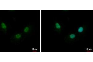 ICC/IF Image NTH1 antibody detects NTH1 protein at nucleus by immunofluorescent analysis.