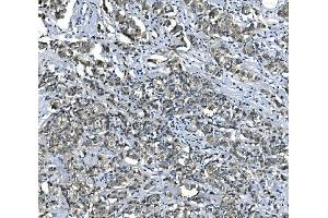 IHC analysis of eRF1/ETF1 using anti-eRF1/ETF1 antibody (ABIN7602626).