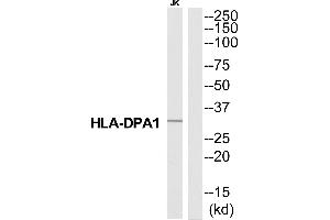 Western blot analysis of extracts from Jurkat cells, using HA2Q antibody. (HLA-DPA1 抗体  (N-Term))