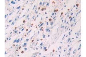 Immunohistochemistry (IHC) image for anti-Protein S (PROS) (AA 481-667) antibody (ABIN7438076)