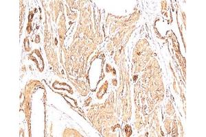 Immunohistochemistry (IHC) image for anti-Actin, alpha 2, Smooth Muscle, Aorta (ACTA2) (N-Term) antibody (ABIN3024128)