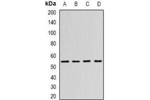Western blot analysis of N-WASP expression in SW480 (A), MCF7 (B), mouse brain (C), mouse kidney (D) whole cell lysates. (Neural Wiskott-Aldrich syndrome protein (WASL) 抗体)