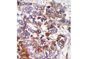 Image no. 2 for anti-Protein Kinase, CGMP-Dependent, Type I (PRKG1) (C-Term) antibody (ABIN360422)