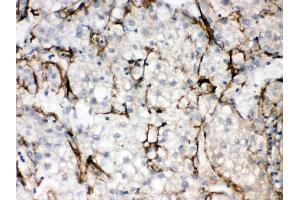 Anti- SLC10A1 Picoband antibody, IHC(P) IHC(P): Human Liver Cancer Tissue (SLC10A1 抗体  (C-Term))