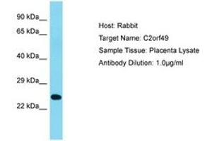Image no. 1 for anti-Chromosome 2 Open Reading Frame 49 (C2orf49) (AA 93-142) antibody (ABIN6750665) (C2orf49 抗体  (AA 93-142))