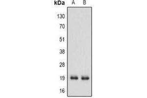Western blot analysis of IFN alpha 1 expression in MCF7 (A), A549 (B) whole cell lysates. (IFNA1 抗体  (C-Term))