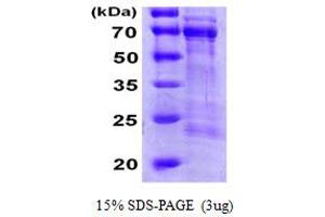SDS-PAGE (SDS) image for Cell Division Cycle 25 Homolog A (S. Pombe) (CDC25A) (AA 1-524) protein (His tag) (ABIN6386706) (CDC25A Protein (AA 1-524) (His tag))