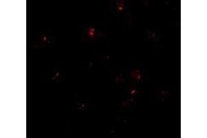 Immunofluorescence of PEN2 in K562 cells with this product at 20 μg/ml. (PEN2 抗体  (C-Term))
