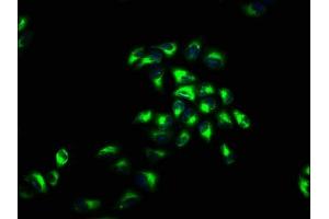 Immunofluorescence staining of Hela cells with ABIN7148413 at 1:66, counter-stained with DAPI.