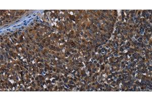 Immunohistochemistry of paraffin-embedded Human tonsil using GALT Polyclonal Antibody at dilution of 1:30 (GALT 抗体)