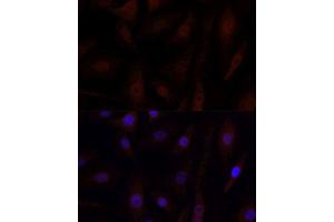 Immunofluorescence (IF) image for anti-Yes-Associated Protein 1 (YAP1) antibody (ABIN1683302)
