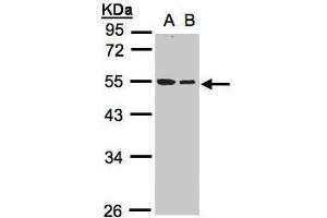 WB Image Sample(30 ug whole cell lysate) A:A431, B:Hep G2 , 10% SDS PAGE antibody diluted at 1:1000 (TUBB1 抗体)
