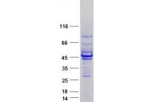 Western Blotting (WB) image for Actin, Alpha, Cardiac Muscle 1 (ACTC1) protein (Myc-DYKDDDDK Tag) (ABIN2714587)