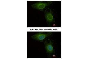 ICC/IF Image Immunofluorescence analysis of methanol-fixed HeLa, using PHGDH, antibody at 1:500 dilution. (PHGDH 抗体  (N-Term))