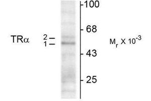 Western Blotting (WB) image for anti-Thyroid Hormone Receptor, alpha (THRA) (N-Term) antibody (ABIN371843) (THRA 抗体  (N-Term))