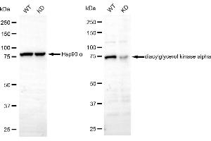 Western blotting analysis using diacylglycerol kinase alpha antibody (ABIN7798324). (Recombinant DGKA 抗体)
