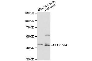 Western blot analysis of extracts of various cell lines, using SLC37A4 antibody. (SLC37A4 抗体)