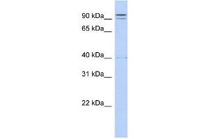 WB Suggested Anti-TTC14 Antibody Titration:  0. (TTC14 抗体  (N-Term))