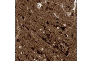 Immunohistochemical staining of human cerebral cortex with HS6ST2 polyclonal antibody  shows strong cytoplasmic positivity in neuronal cells at 1:50-1:200 dilution. (HS6ST2 抗体)