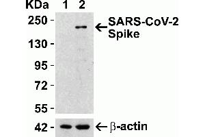 Overexpression Validation in Spike Transfected 293 Cells Loading: 10 μg per lane of 293 cell lysate. (SARS-CoV-2 Spike 抗体  (RBD))