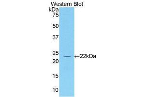 Western Blotting (WB) image for anti-Neuropilin 1 (NRP1) (AA 645-821) antibody (ABIN1173426) (Neuropilin 1 抗体  (AA 645-821))