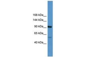 Image no. 1 for anti-Apolipoprotein A (APOA) (AA 3962-4011) antibody (ABIN6746793) (LPA 抗体  (AA 3962-4011))